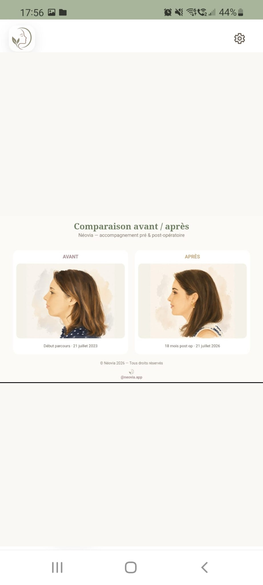 Outil Néovia pour suivre l’évolution du visage et créer un avant-après après une chirurgie maxillo-faciale